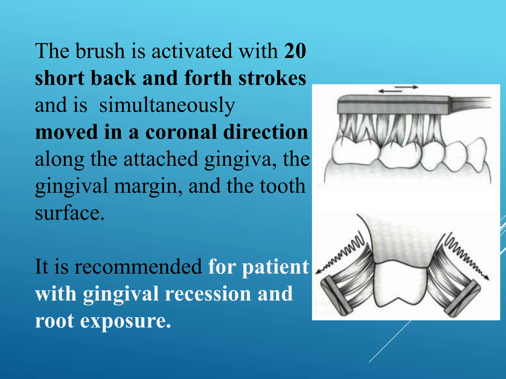 The brush is activated with 20
short back and forth strokes
and is simultaneously
moved in a coronal direction
along the attached gingiva, the
gingival margin, and the tooth
surface.
It is recommended for patient
with gingival recession and
root exposure.
 