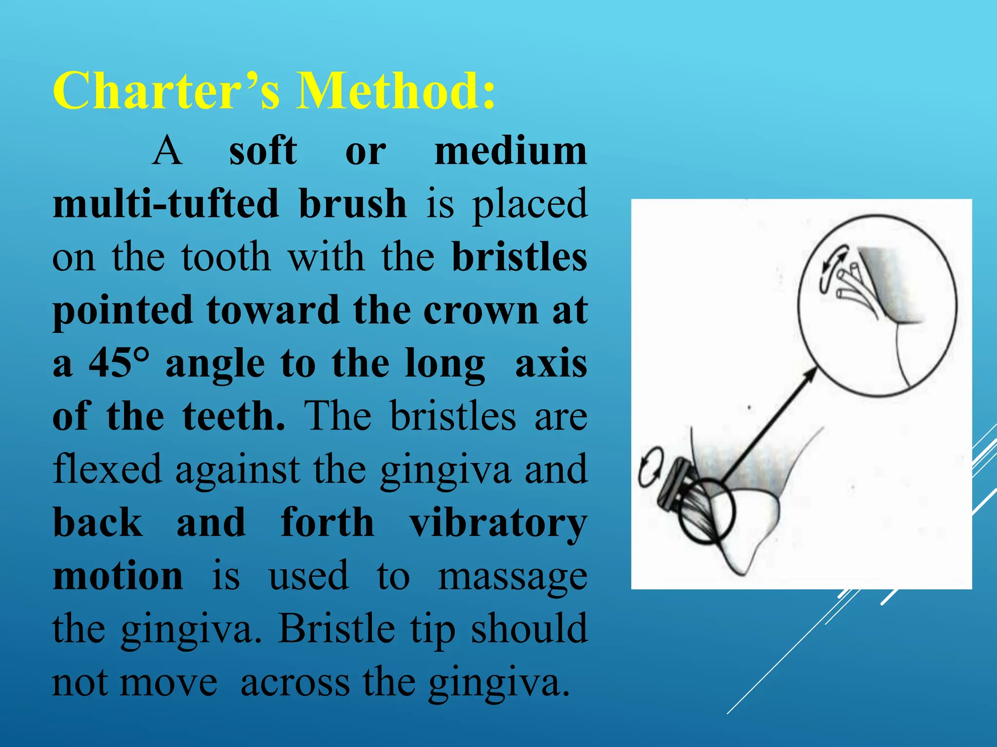 Charter’s Method:
A soft or medium
multi-tufted brush is placed
on the tooth with the bristles
pointed toward the crown at
a 45° angle to the long axis
of the teeth. The bristles are
flexed against the gingiva and
back and forth vibratory
motion is used to massage
the gingiva. Bristle tip should
not move across the gingiva.
 