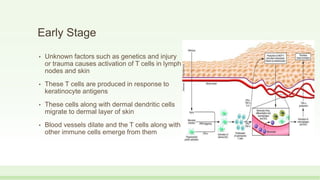 Early Stage
• Unknown factors such as genetics and injury
or trauma causes activation of T cells in lymph
nodes and skin
• These T cells are produced in response to
keratinocyte antigens
• These cells along with dermal dendritic cells
migrate to dermal layer of skin
• Blood vessels dilate and the T cells along with
other immune cells emerge from them
 