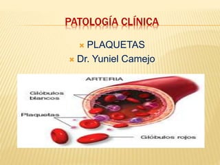 PATOLOGÍA CLÍNICA
 PLAQUETAS
 Dr. Yuniel Camejo
 