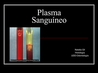 Plasma Sanguíneo Natalia Gil Histología UDD-Odontología 