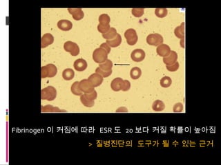 Fibrinogen 이 커짐에 따라  ESR 도  20 보다 커질 확률이 높아짐 >  질병진단의  도구가 될 수 있는 근거 