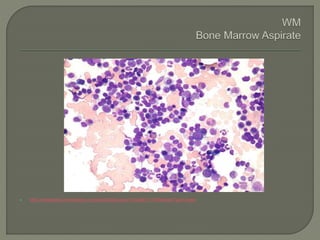  http://imagebank.hematology.org/AssetDetail.aspx?AssetID=1178&AssetType=Asset
 