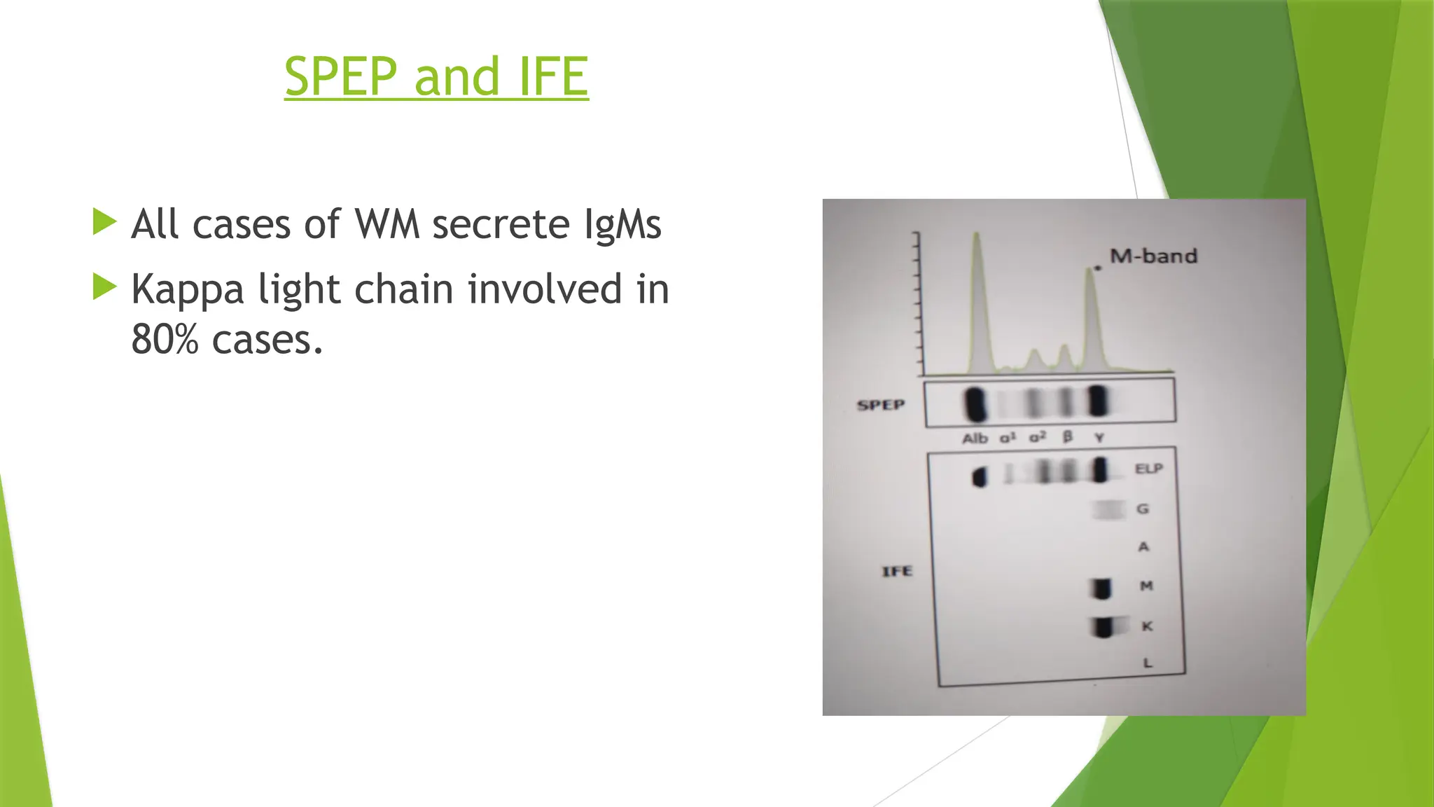 SPEP and IFE
 All cases of WM secrete IgMs
 Kappa light chain involved in
80% cases.
 
