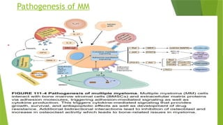 Pathogenesis of MM
 