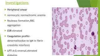 Investigations
 Peripheral smear
 normocytic normochromic anemia
 Rouleaux formation,RBC
aggregation
 ESR elevated
 Coagulation profile-
abnormality(due to IgM in fibrin
crosslinks interfere)
 LFT-A:G reversal,elevated
 