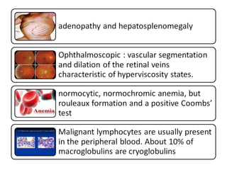 Plasma cell disorders | PPT