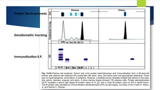 Protein Electrophoresis
Densitometric tracking
Immunofixation E.P.
 