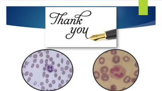 Plasma cell Neoplasms 2021.pdf