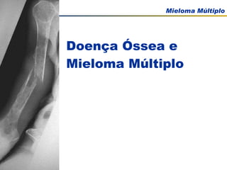 Doença Óssea e Mieloma Múltiplo  