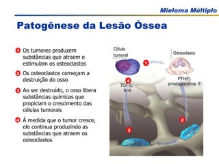 Patogênese da Lesão Óssea 4 1 2 3 Célula  tumoral Osteoclasto PTHrP, prostaglandina  E TGF-  ,  IL-6 Os tumores produzem substâncias que atraem e estimulam os osteoclastos 1 2 Os osteoclastos começam a destruição do osso 3 Ao ser destruído, o osso libera substâncias químicas que propiciam o crescimento das células tumorais  4 À medida que o tumor cresce, ele continua produzindo as substâncias que atraem os osteoclastos  