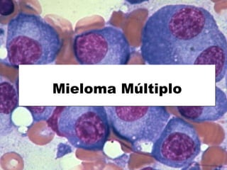 Mieloma Múltiplo 