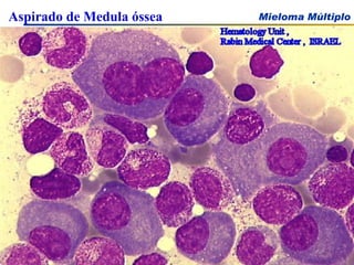 Aspirado de Medula óssea 