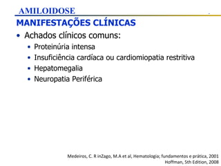 MANIFESTAÇÕES CLÍNICAS Achados clínicos comuns: Proteinúria intensa Insuficiência cardíaca ou cardiomiopatia restritiva Hepatomegalia Neuropatia Periférica Medeiros, C. R inZago, M.A et al, Hematologia; fundamentos e prática, 2001 Hoffman, 5th Edition, 2008 AMILOIDOSE 