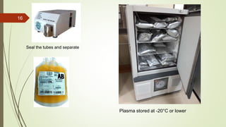 16
Seal the tubes and separate
Plasma stored at -20°C or lower
 