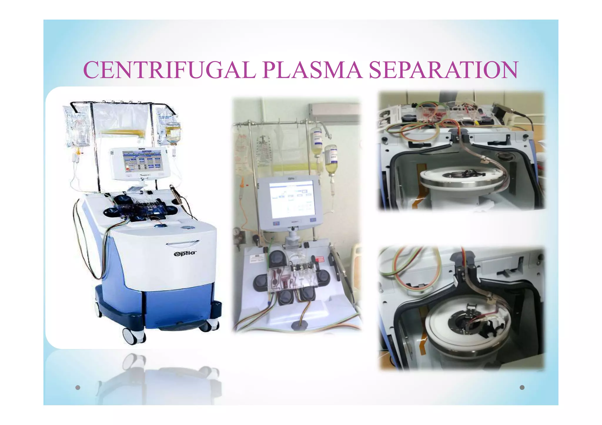 CENTRIFUGAL PLASMA SEPARATION
 