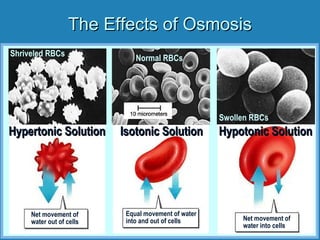 Normal RBCs
Isotonic SolutionIsotonic Solution
The Effects of OsmosisThe Effects of Osmosis
Equal movement of water
into and out of cells
Net movement of
water out of cells Net movement of
water into cells
Shriveled RBCs
Swollen RBCs
Hypertonic SolutionHypertonic Solution Hypotonic SolutionHypotonic Solution
 