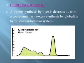  CIRRHOSIS OF LIVER :
 Albumin synthesis by liver is decreased , with
a complementary excess synthesis by globulins
by reticuloendothelial system
 
