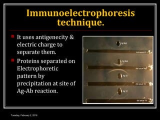 Immunoelectrophoresis
technique.
 It uses antigenecity &
electric charge to
separate them.
 Proteins separated on
Electrophoretic
pattern by
precipitation at site of
Ag-Ab reaction.
Tuesday, February 2, 2016
 