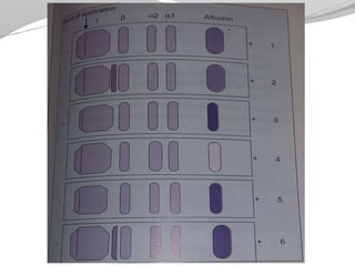 Plasma proteins class | PPTX