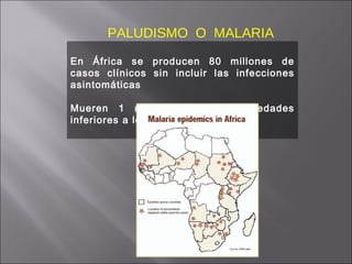 En África se producen 80 millones de casos clínicos sin incluir las infecciones asintomáticas Mueren 1 millón de niños en edades inferiores a los 5 años PALUDISMO  O  MALARIA 