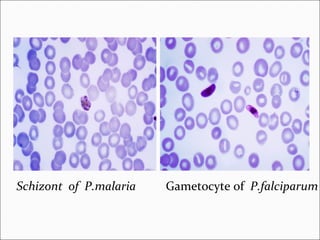 Schizont of P.malaria Gametocyte of P.falciparum
 