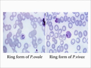 Ring form of P.ovale Ring form of P.vivax
 