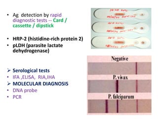 • Ag detection by rapid
diagnostic tests -- Card /
cassette / dipstick
• HRP-2 (histidine-rich protein 2)
• pLDH (parasite lactate
dehydrogenase)
 Serological tests
• IFA ,ELISA, RIA,IHA
 MOLECULAR DIAGNOSIS
• DNA probe
• PCR
 
