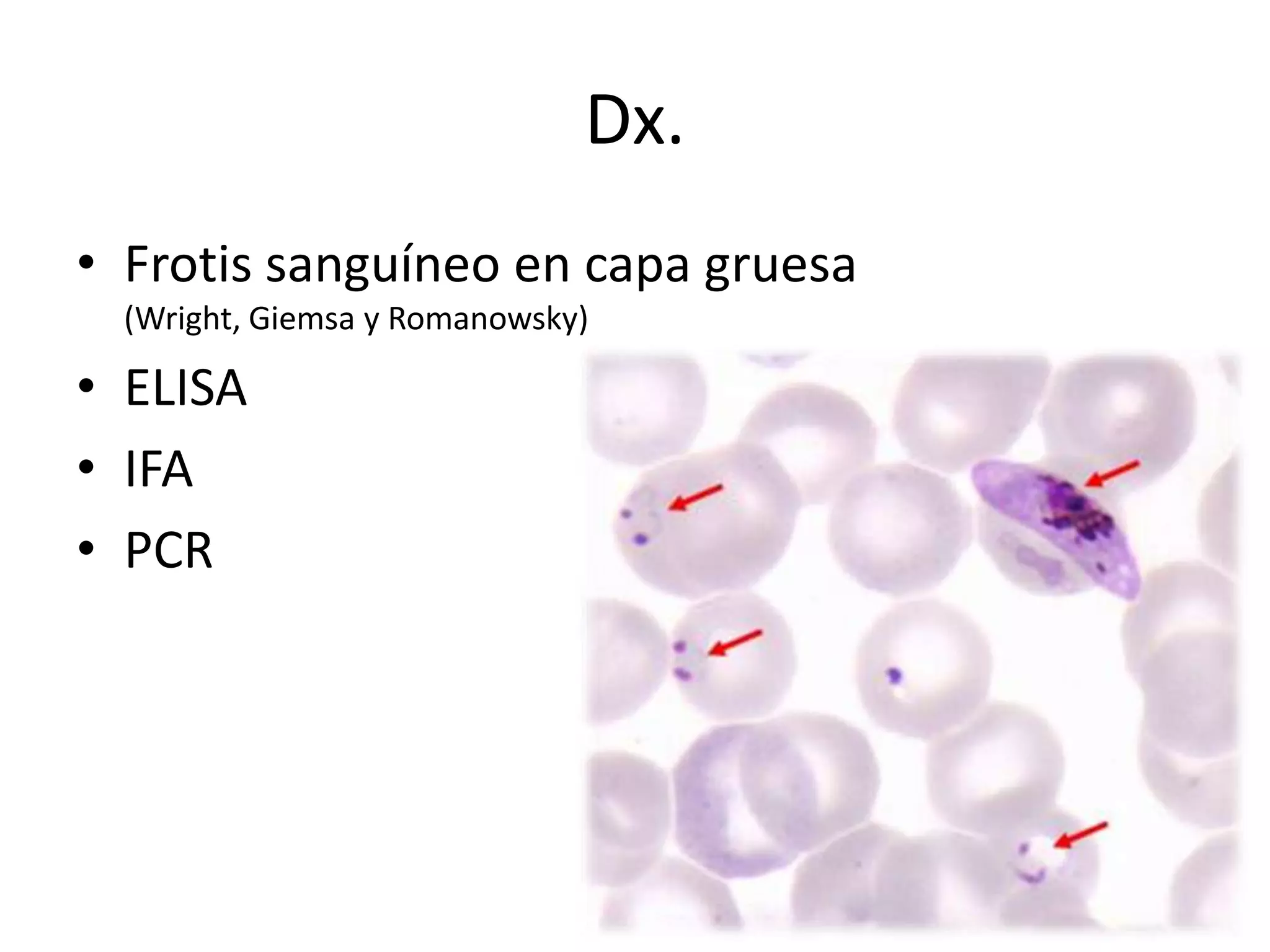 Dx.Frotis sanguíneo en capa gruesa (Wright, Giemsa y Romanowsky)ELISAIFAPCR