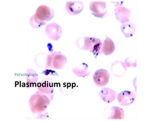 Plasmodiumspp. Parasitología 