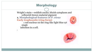 Morphology
Wright’s stain---reddish nuclei; bluish cytoplasm and
yellowish brown malarial pigment
1. Morphological features of P. vivax
Early trophozoite (ring form)
1 red nucleus on the ring-like light blue cytoplasm ;
single
infection in a cell.
.
 