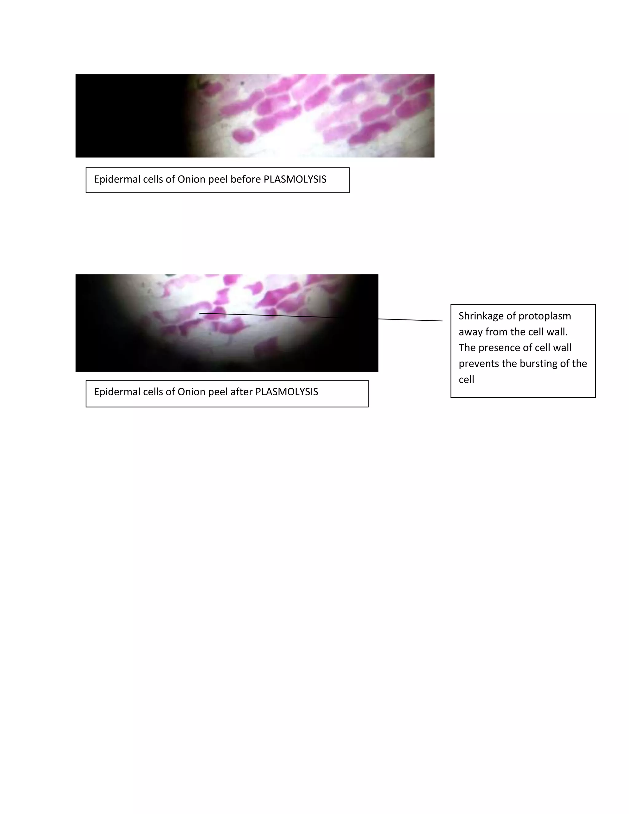 Epidermal cells of Onion peel before PLASMOLYSIS
Epidermal cells of Onion peel after PLASMOLYSIS
Shrinkage of protoplasm
away from the cell wall.
The presence of cell wall
prevents the bursting of the
cell