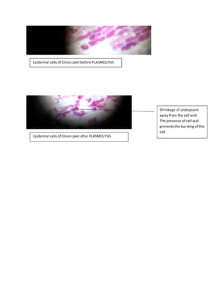 Epidermal cells of Onion peel before PLASMOLYSIS
Epidermal cells of Onion peel after PLASMOLYSIS
Shrinkage of protoplasm
away from the cell wall.
The presence of cell wall
prevents the bursting of the
cell
 