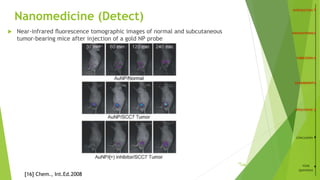 Nanomedicine (Detect)
 Near-infrared ﬂuorescence tomographic images of normal and subcutaneous
tumor-bearing mice after injection of a gold NP probe
CONCLUSION
YOUR
QUESTIONS
[16] Chem., Int.Ed.2008
/2619
 