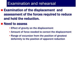 Examination and rehearsal
 Examination of the displacement and
  assessment of the forces required to reduce
  and hold the reduction.
 Need to assess
     •Effect of gravity on the displacement
     •Amount of force needed to correct the displacement
     •Range of excursion from the position of greatest
      deformity to the position of apparent reduction
 