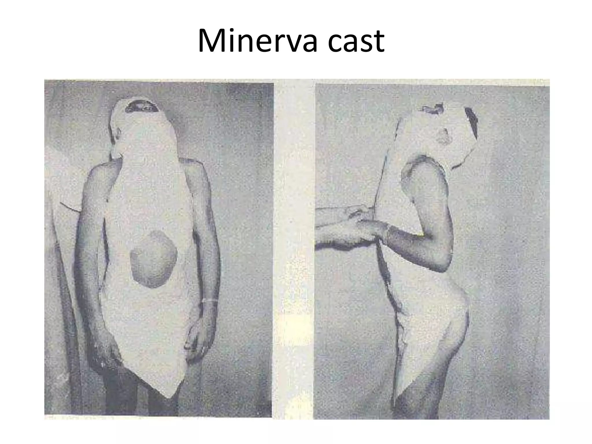Minerva cast

 