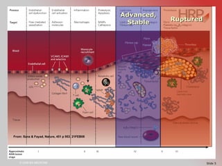 Mechanisms of Plaque Rupture in Advanced Atherosclerosis | PPT