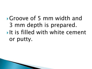 Groove of 5 mm width and 3 mm depth is prepared.It is filled with white cement or putty.