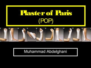 Plaster of Paris 
(POP) 
Muhammad Abdelghani 
 