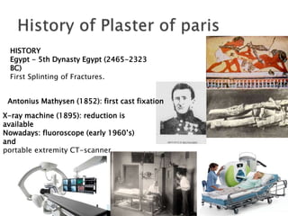 Plaster of paris, Definition, Uses, & History