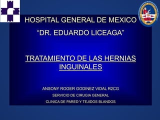 HOSPITAL GENERAL DE MEXICO
“DR. EDUARDO LICEAGA”
TRATAMIENTO DE LAS HERNIAS
INGUINALES
ANSONY ROGER GODINEZ VIDAL R2CG
SERVICIO DE CIRUGIA GENERAL
CLINICA DE PARED Y TEJIDOS BLANDOS
 