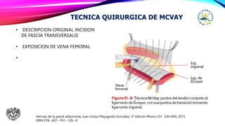 Mcvay Incision PLASTIAS CON TENSION Y SIN TENSION.pptx