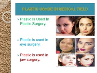  Plastic Is Used In
Plastic Surgery.
 Plastic is used in
eye surgery.
 Plastic is used in
jaw surgery.
 