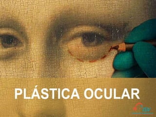 Plastica ocular