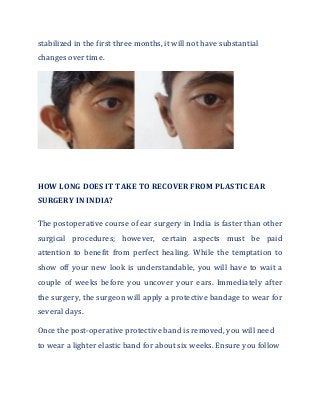 stabilized in the first three months, it will not have substantial
changes over time.
HOW LONG DOES IT TAKE TO RECOVER FROM PLASTIC EAR
SURGERY IN INDIA?
The postoperative course of ear surgery in India is faster than other
surgical procedures; however, certain aspects must be paid
attention to benefit from perfect healing. While the temptation to
show off your new look is understandable, you will have to wait a
couple of weeks before you uncover your ears. Immediately after
the surgery, the surgeon will apply a protective bandage to wear for
several days.
Once the post-operative protective band is removed, you will need
to wear a lighter elastic band for about six weeks. Ensure you follow
 