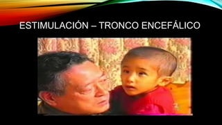 ESTIMULACIÓN – TRONCO ENCEFÁLICO
 