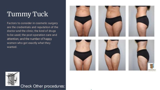 Plastic Surgeons Near Me