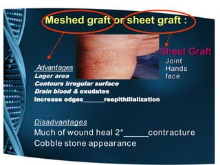 Meshed graft or sheet graft :
Advantages
Lager area
Contours irregular surface
Drain blood & exudates
Increase edges_______reepithilialization
Disadvantages
Much of wound heal 2*______contracture
Cobble stone appearance
Sheet Graft
Joint
Hands
face
 