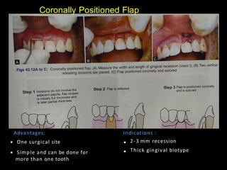 Pps Surgery Periodontal Plastic Surgery (PPS) is a branch of periodontics | PDF