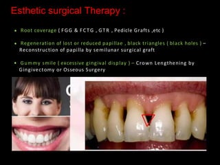 Pps Surgery Periodontal Plastic Surgery (PPS) is a branch of periodontics | PDF
